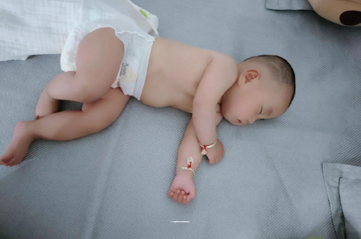 苍南六个月宝宝眼睛散光
